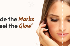 How to Get Rid of Dark Spots ft. Kojic Acid Face Serum?