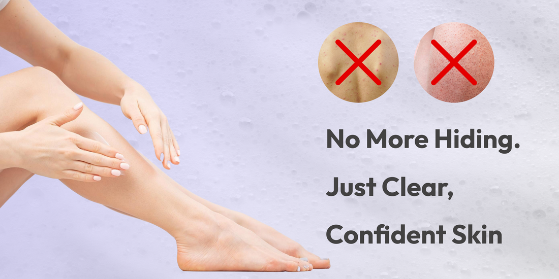 Bacne & Strawberry Legs: Causes, Prevention & Treatments That Work