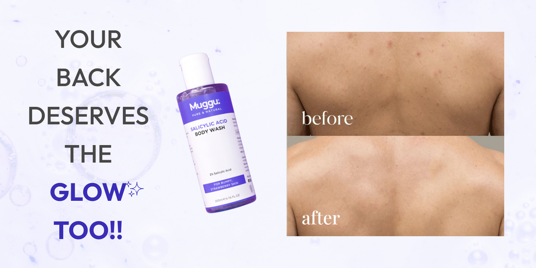 Bacne to Glow: Step-by-Step Body Routine with Salicylic Acid Wash
