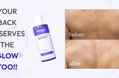 Bacne to Glow: Step-by-Step Body Routine with Salicylic Acid Wash