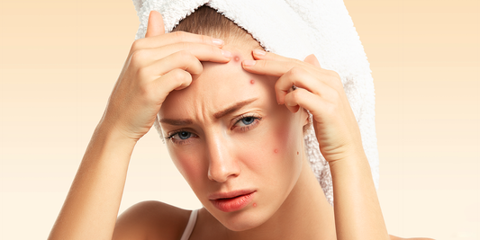 How Stress Affects Your Skin And What You Can Do About It?