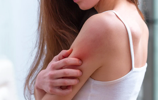 Skin Care Products To Reduce Itching Caused By Keto Diet