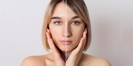 Unveiling the Secrets of Youth: The Science Behind Anti-Aging Skincare