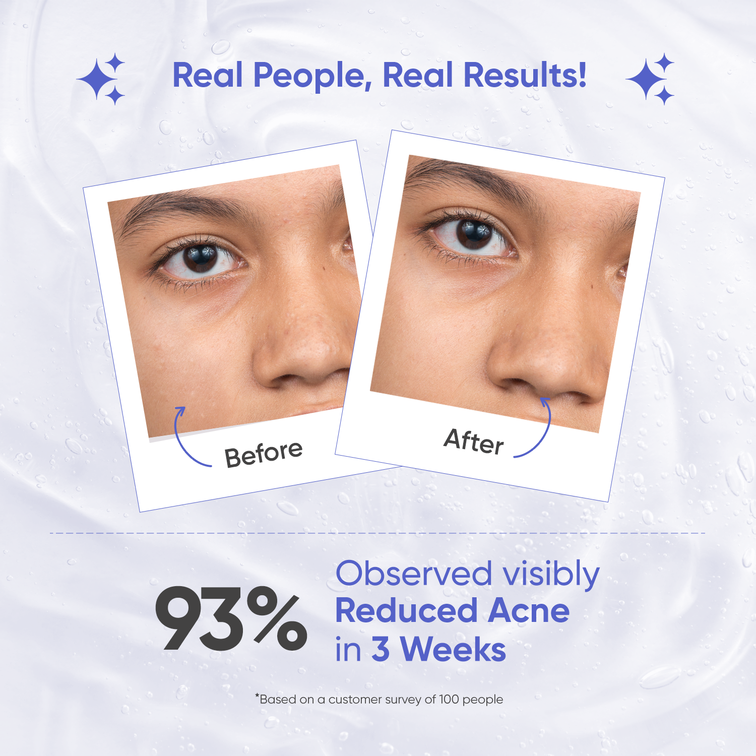 Shop 2 Salicylic Acid Face Wash For Acne Muggu SkinCare